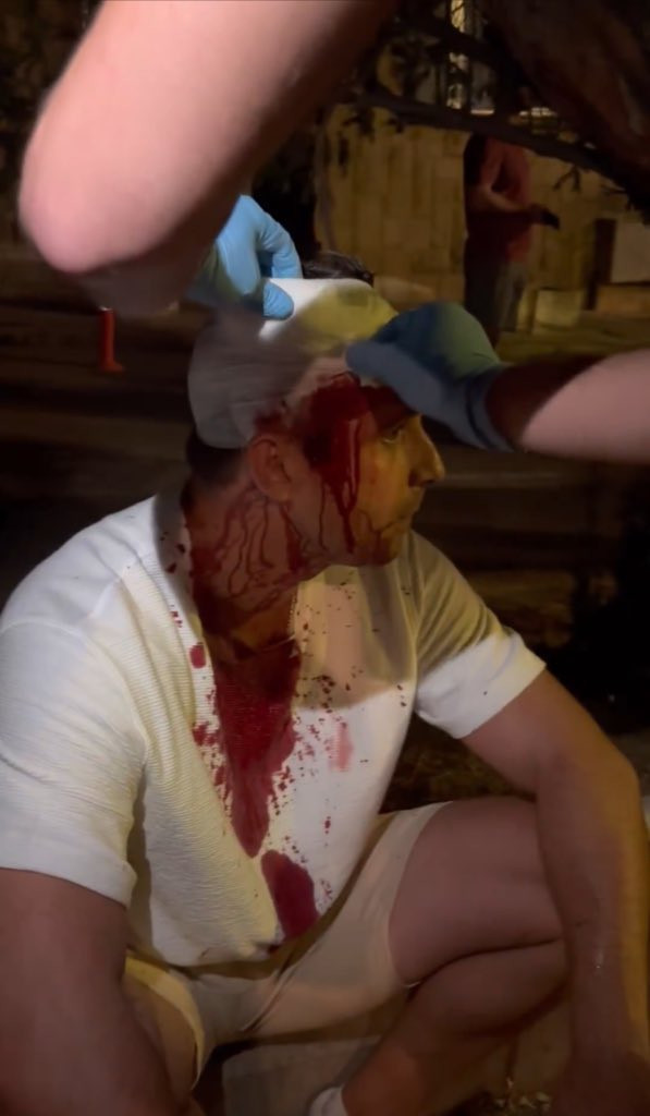 Serbian opposition politician injured in the protests